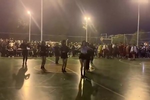 老婆这刮痧是去致敬麦迪吗？还真有点像啊